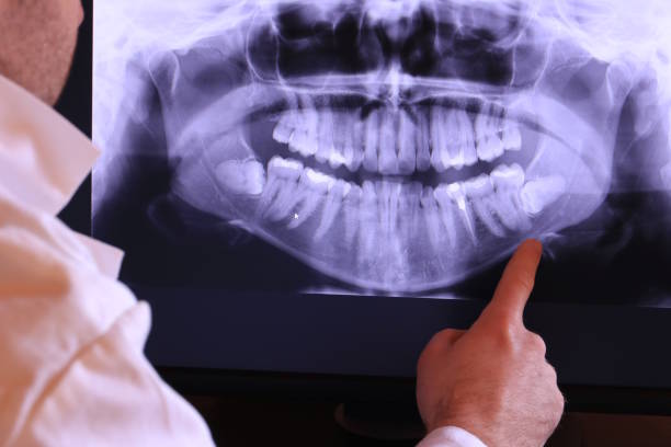Best Emergency TMJ Treatment in Welcome, SC
