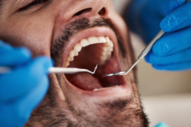 Best Emergency Gum Treatment in Welcome, SC