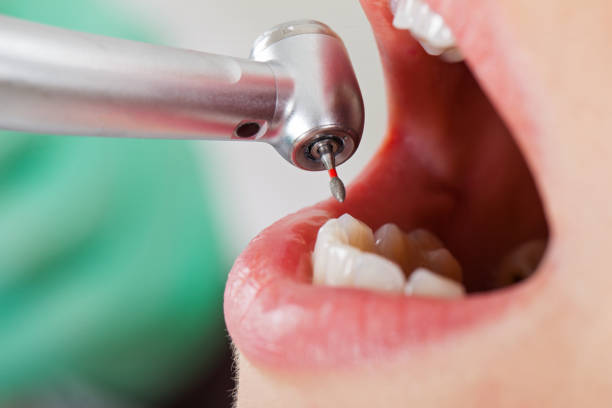 Best Urgent Care for Lost Fillings or Crowns in Welcome, SC